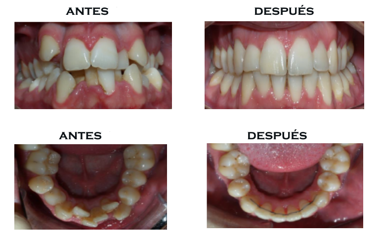 Nuestros casos Nuestros casos