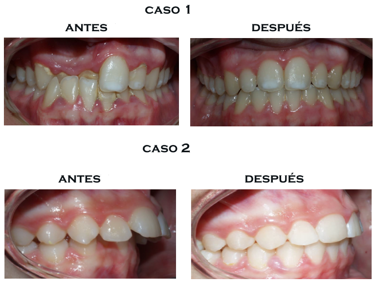 Nuestros casos Nuestros casos